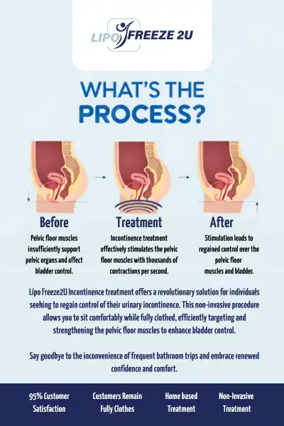 Diagram of how incontinence treatment Whitby works.